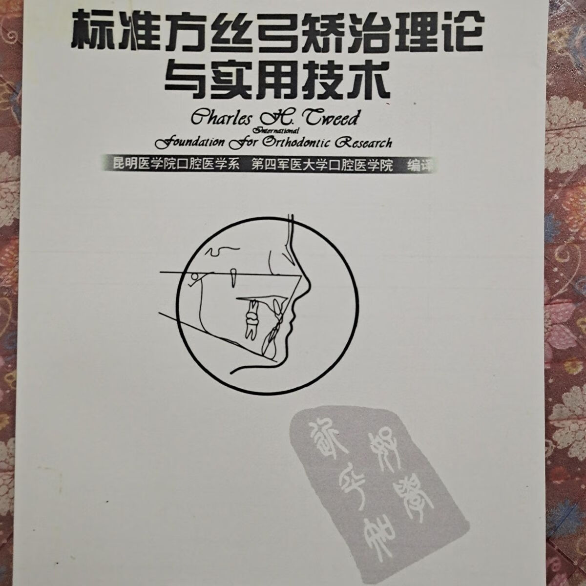 tweed-merrifield方丝弓矫治与实用