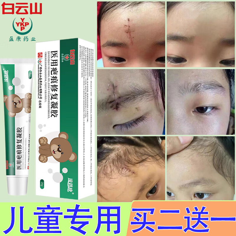 疤痕修复淡疤膏除婴儿去疤痕修复凝胶痕 膏儿童一盒装适用于1c疤痕