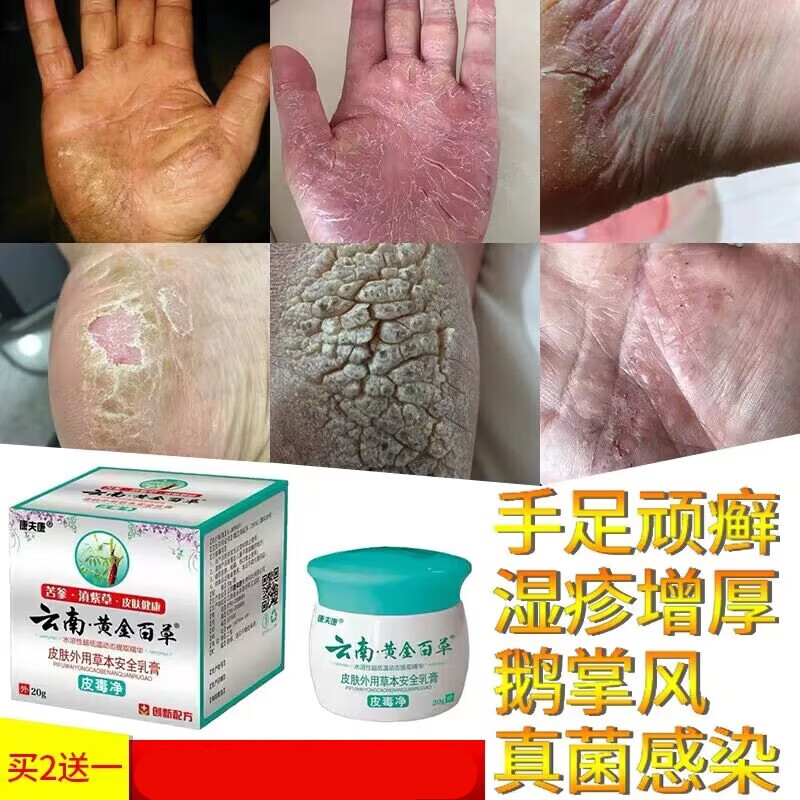 康夫康云南黄金百草膏皮l炎湿l疹痒顽固性皮肤瘙痒成人癣菌私处瘙痒 