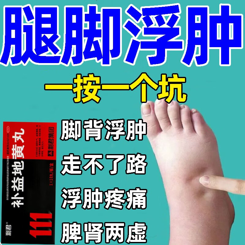 浮肿吃什么药 脚背肿痛 脾肾两虚水肿药 四肢浮肿走不了路浮肿疼痛