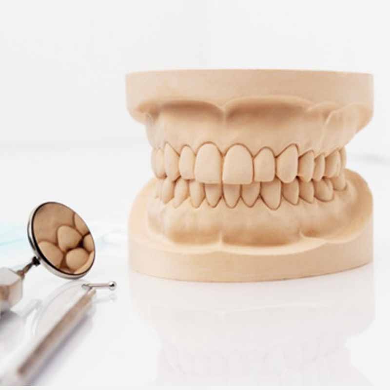 取牙模材料 牙模制作包牙膜制作全口牙模 做牙齿石膏模型 取模6次材料