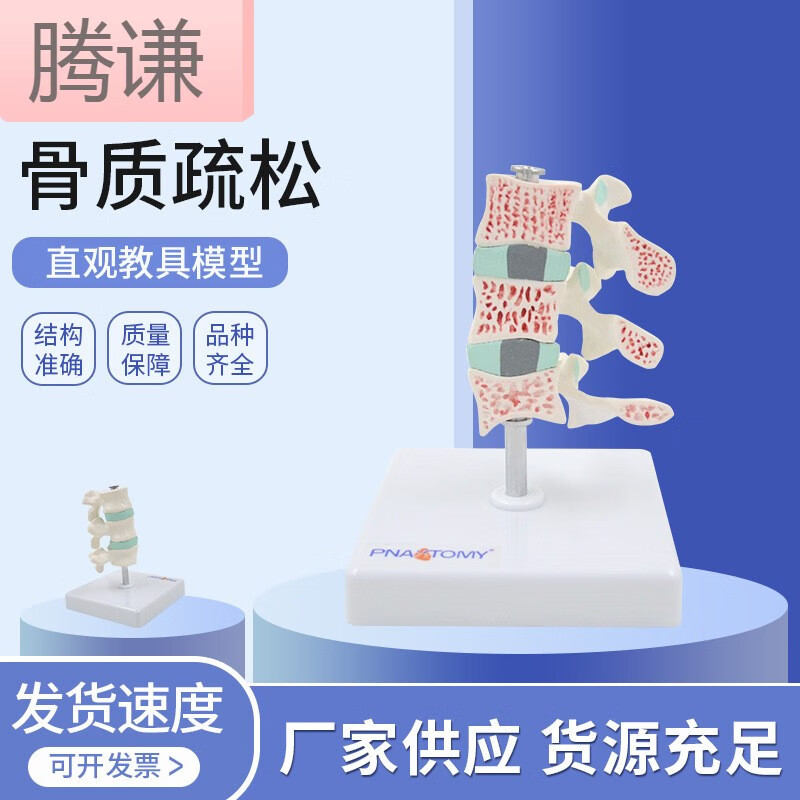 人體骨骼 骨質(zhì)疏松病變模型 脊椎頸椎解刨模型 關(guān)節(jié)模型骨骼模型 型骨骼模型