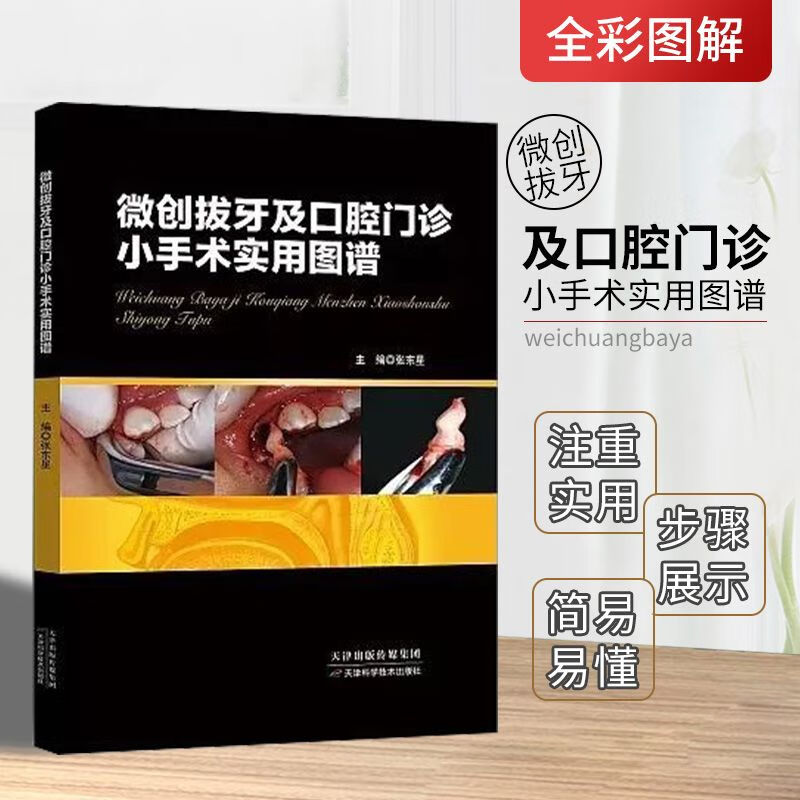 微创拔牙及门诊小手术实用图谱 张东星主编