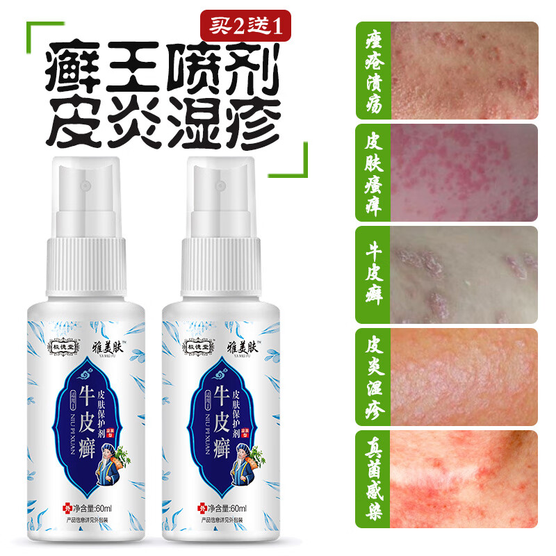 手足藓痒清皮炎湿疹牛皮癣专用苗药顽固牛皮癣银屑i病皮肤癣喷剂体癣药水股癣痒净花斑癣真菌感染疥疮专用膏 癣王喷剂+疥疮膏一支