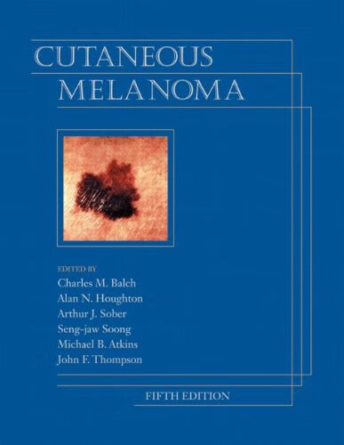 预订 cutaneous melanoma, fifth edition