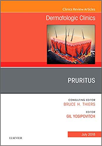 【预订】pruritus, an issue of dermatologic