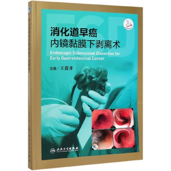 消化道早癌内镜黏膜下剥离术