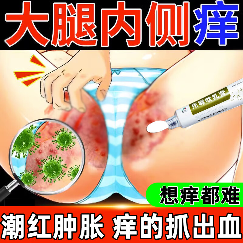 股癣用otc药膏大腿内侧阴囊私处瘙痒体癣 股癣 花斑癣 真菌感染潮红