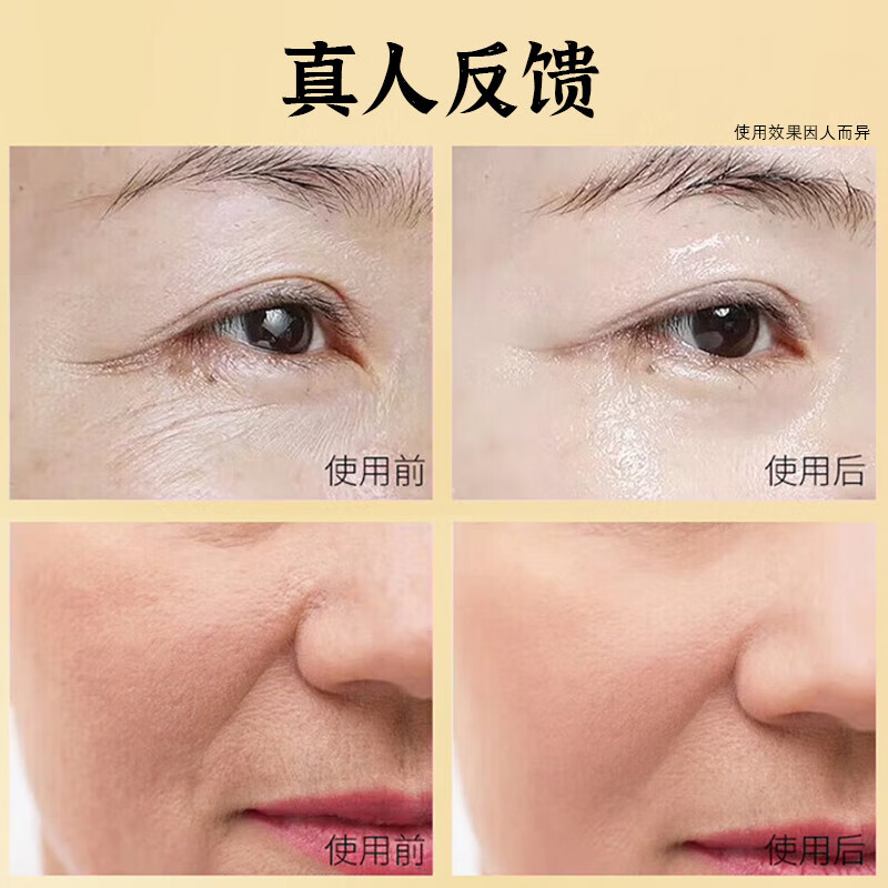 美颜坊男士护肤品套装补水保湿冬天抗皱初衰老淡化细纹擦脸的水乳面霜 【2件套】擦脸的护肤品男女士