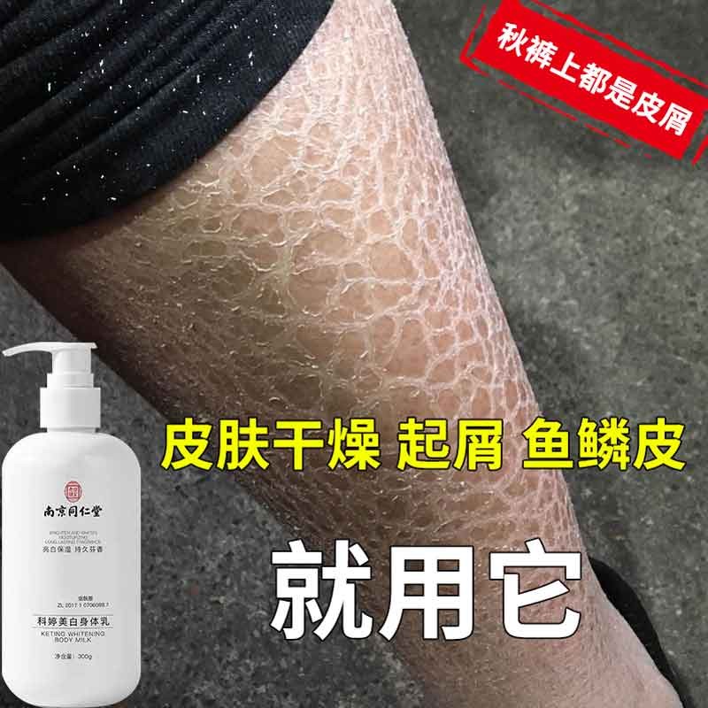 多晒太阳能否缓解鸡皮肤(多晒太阳能否缓解鸡皮肤呢) 多晒太阳能否缓解鸡皮肤(多晒太阳能否缓解鸡皮肤呢)