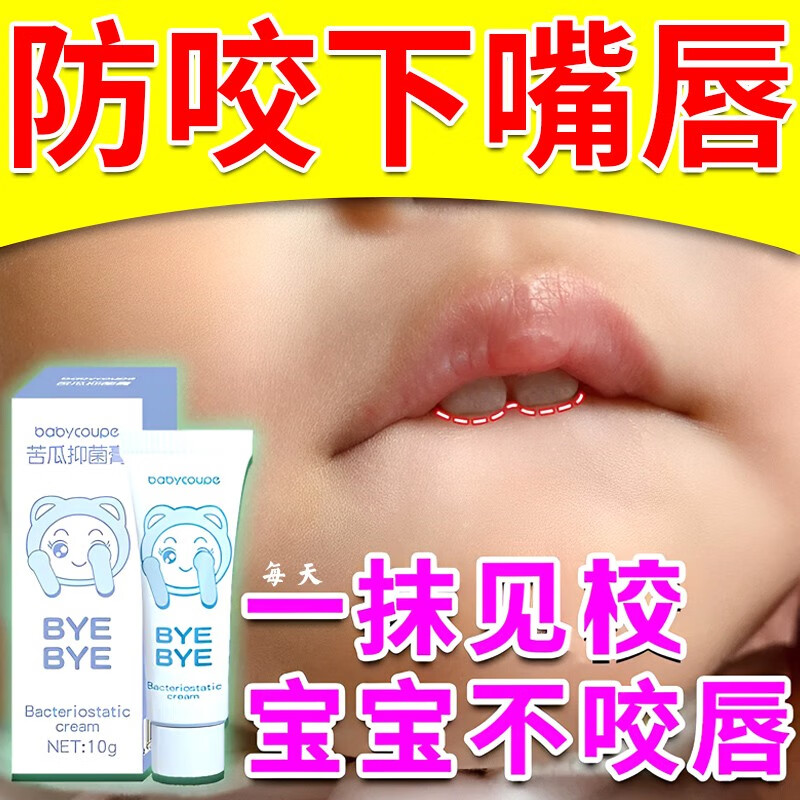 药房直售 防止宝宝咬下嘴唇神器小孩嘴唇外翻嘴凸防