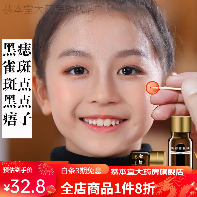 去痣膏去i黑i痣i脸部不留疤点痣药水无痕无痛点斑除痣膏去斑祛痣雀斑