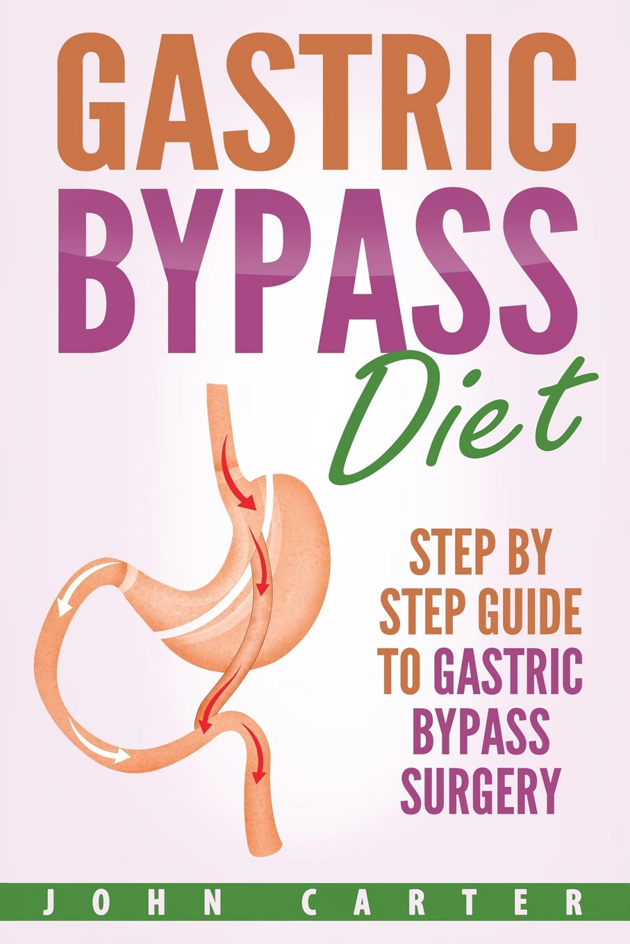 【预售按需印刷】gastric bypass diet