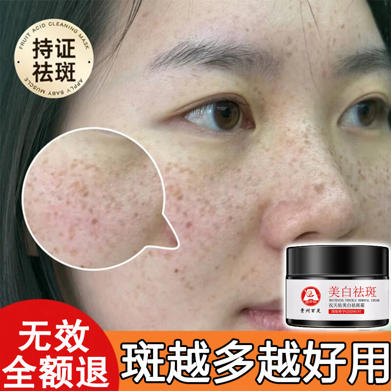 百灵鸟美白祛斑霜雀斑黄褐斑妊娠斑晒斑老年斑保湿补水护肤面霜30g