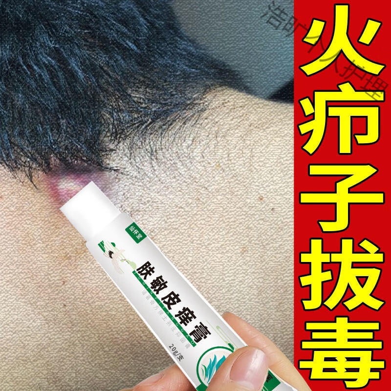 火疖子拔i毒膏屁股疙瘩脓包流脓坐板疮毒痘痘流脓痒疼痛消红肿疙瘩 五