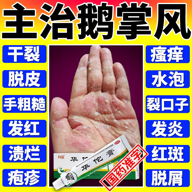 科田 华佗膏 治鹅掌风手足癣症手上小水泡真菌感染干裂脱皮手掌粗糙变