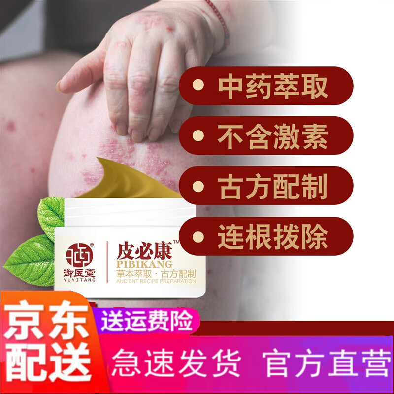 jiky【官方】御医堂皮必康 牛皮头皮去瘙痒顽固型止痒全 4盒