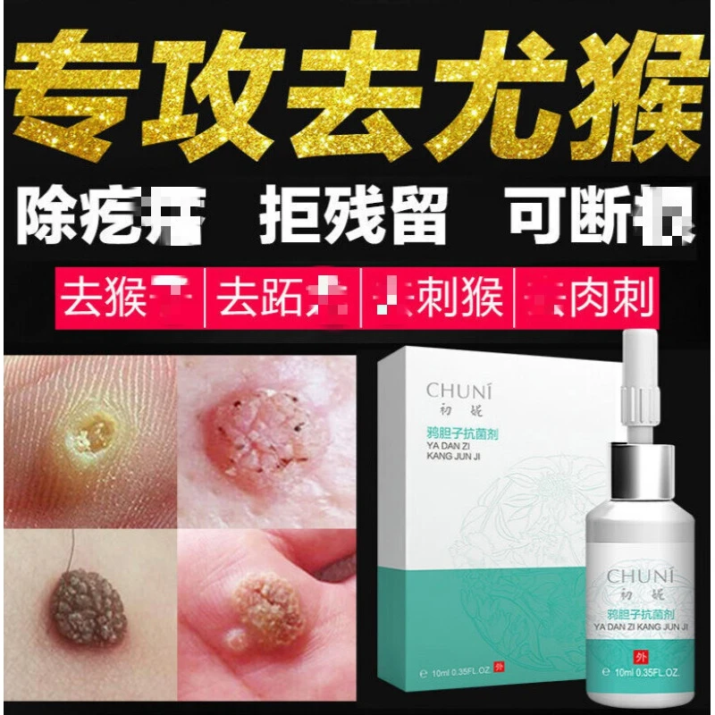 别样缘丝状尤去除小肉瘤肉猴子特傚治刺肉膏肉粒老鼠奶老鼠痣疙瘩