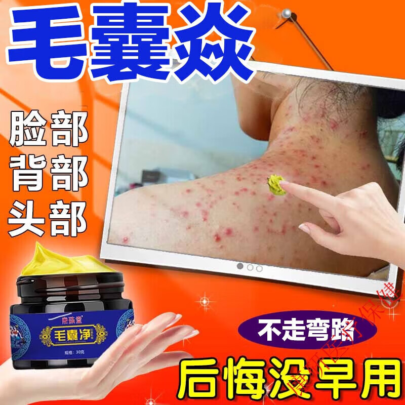 毛囊皮炎药头部脸部长红疙瘩痘痘脓包痤疮膏祛痘湿痒疹