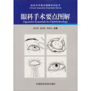 眼科手术要点图解【放心选购】
