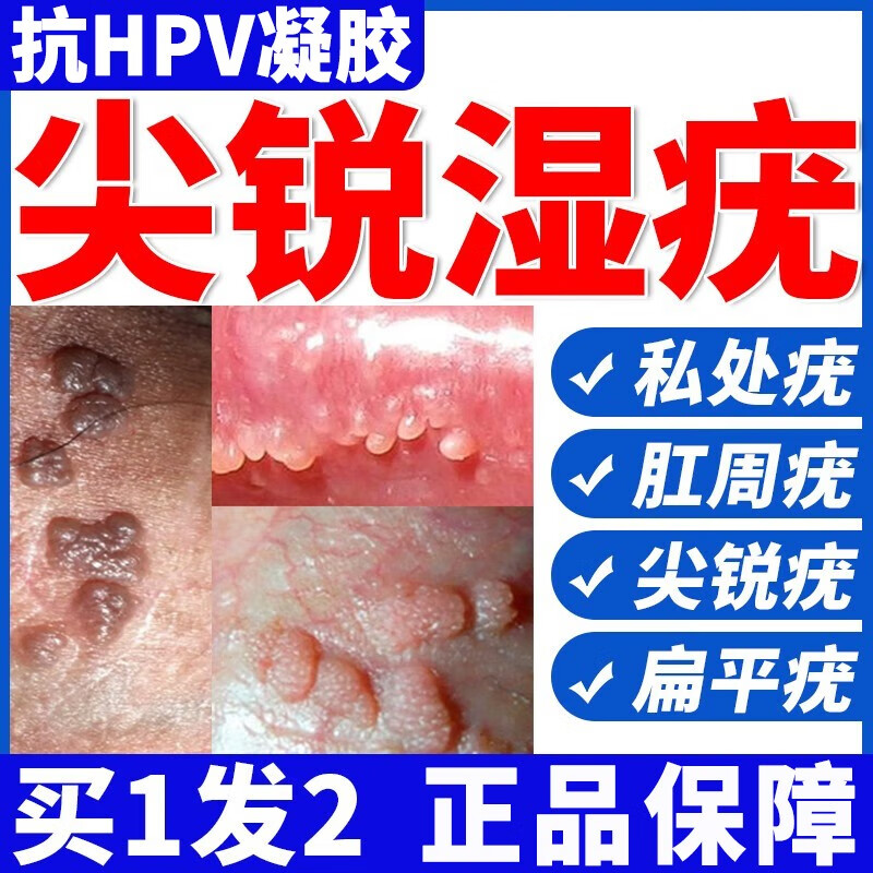 hpv抗病毒专用凝胶干扰素hpv阻断尖锐湿疣私处疹疱人乳头瘤病毒干扰素