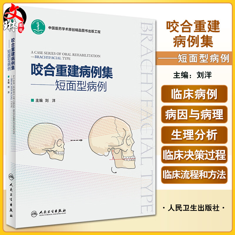咬合重建病例集 短面型病例 刘洋主编 中国医药学术原创精品图书出版工程 口腔颌面部疾病矫形外科学 人民卫生出版社9787117337946怎么看?