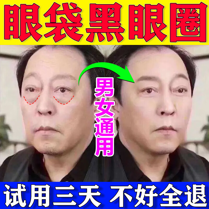 眼袋贴不去大眼袋严重中老年专用搭配消除去除产品眼袋男士眼袋神眼器黑眼圈细纹浮肿熬夜专用护眼贴 买二送一【三盒疗程装】