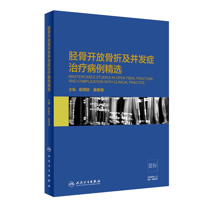 胫骨开放骨折及并发症治疗病例精选(精)