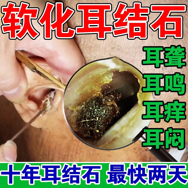 耳结石软化水快速软化液耳朵痒止i痒抑菌取耳屎耳耵聍油专用滴耳 一