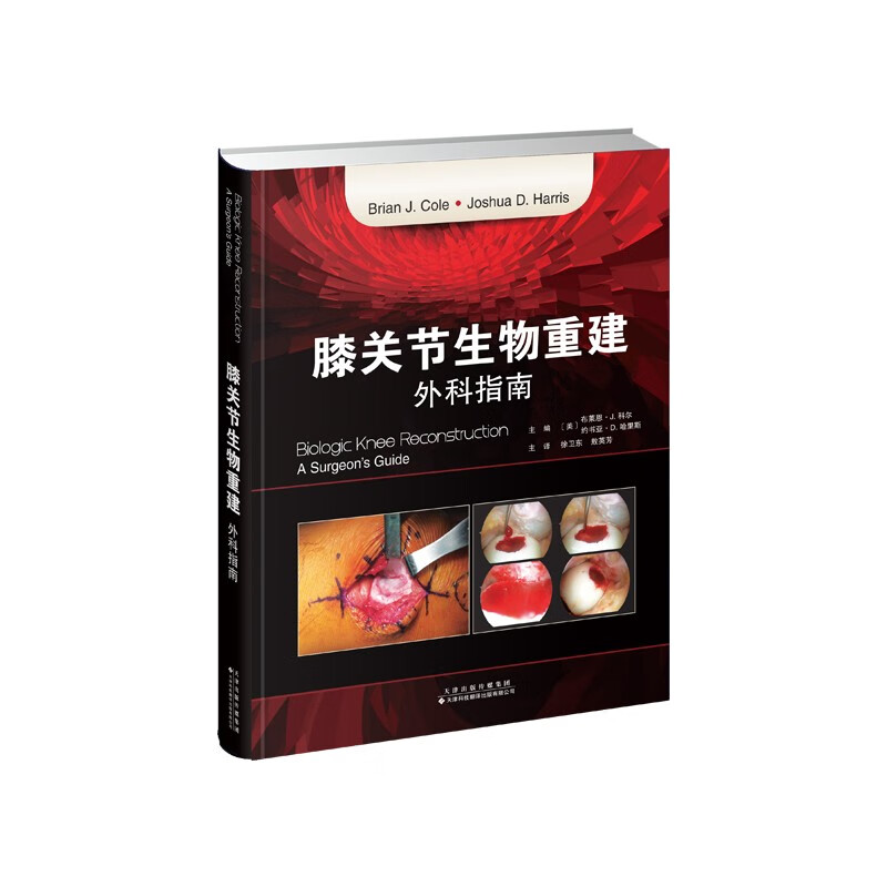 膝关节生物重建:外科指南