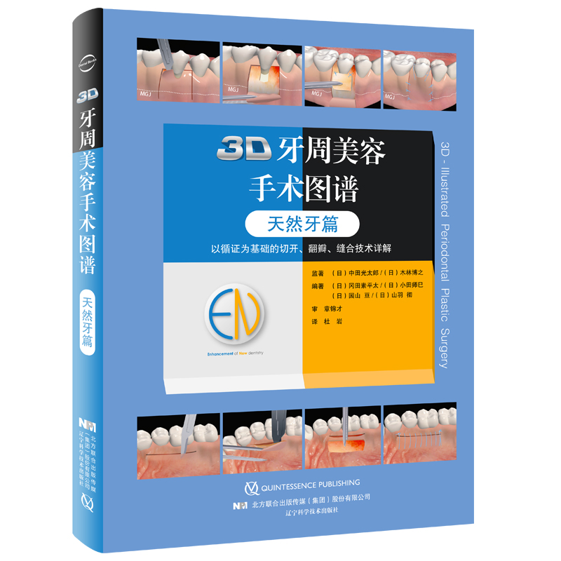 3D牙周美容手术图谱（天然牙篇）