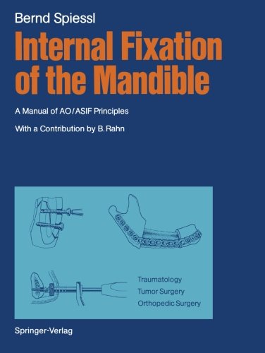 预订 internal fixation of the mandible