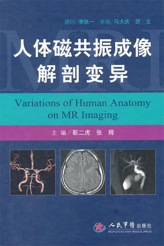 人体磁共振成像解剖变异