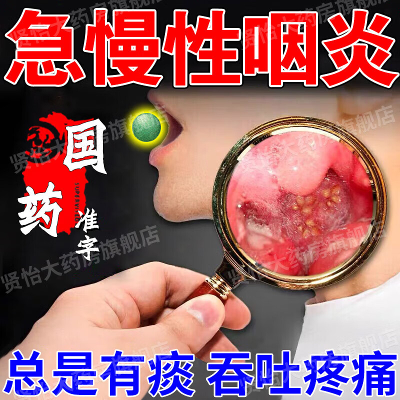 咽喉嗓子痒干咳嗽嗓子特疼急慢性咽喉炎除扁桃体除发炎根有效咽炎药片