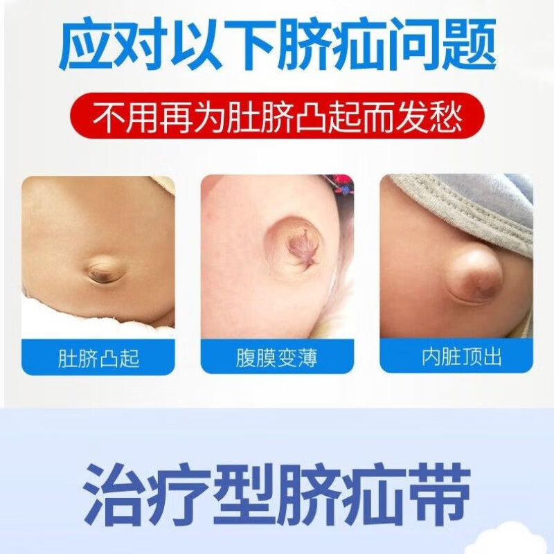 透气婴儿凸肚脐护脐带婴幼儿气肚脐宝宝脐疝带疝气带肚围 一条绑带三