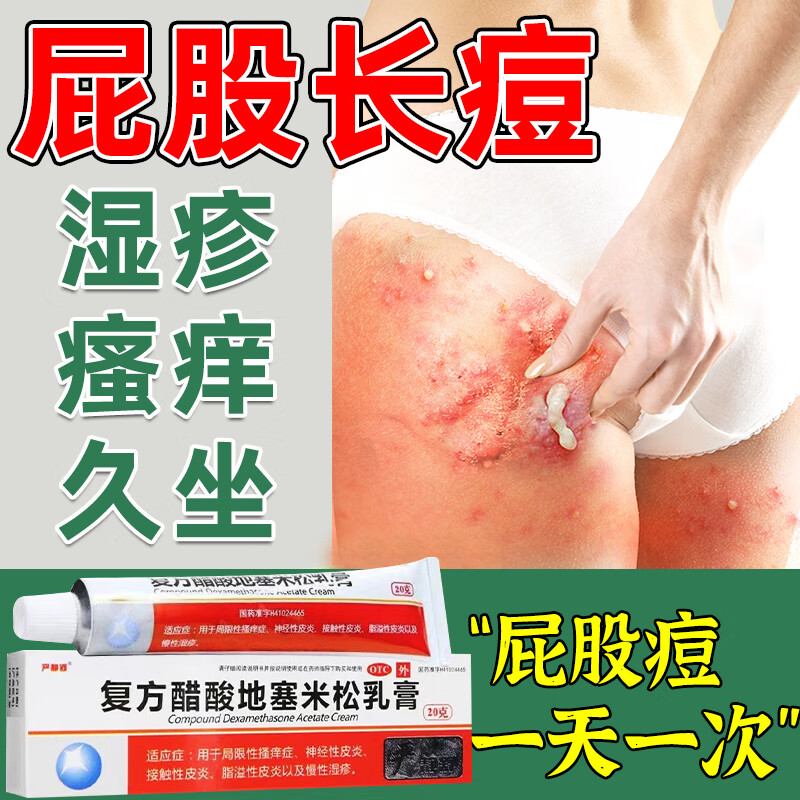 屁股长痘痘脓包疖子治屁股久坐长疙瘩骚痒红肿有硬块坐板疮皮炎湿疹