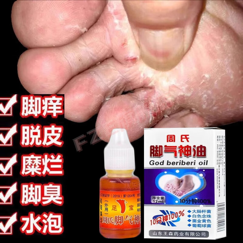 贝因维丝(beiyvs)脚气神油脱皮杀菌烂l脚丫根专用除l臭脚喷雾脚痒水泡