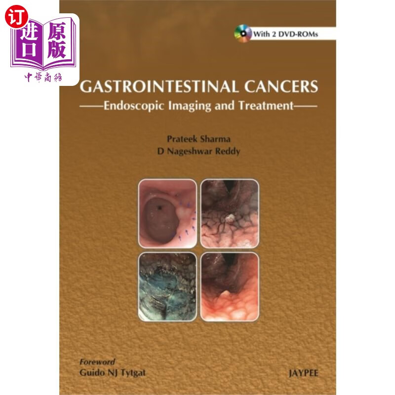 海外直订医药图书gastrointestinal cancers: 胃肠道癌症