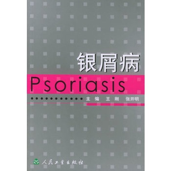 银屑病