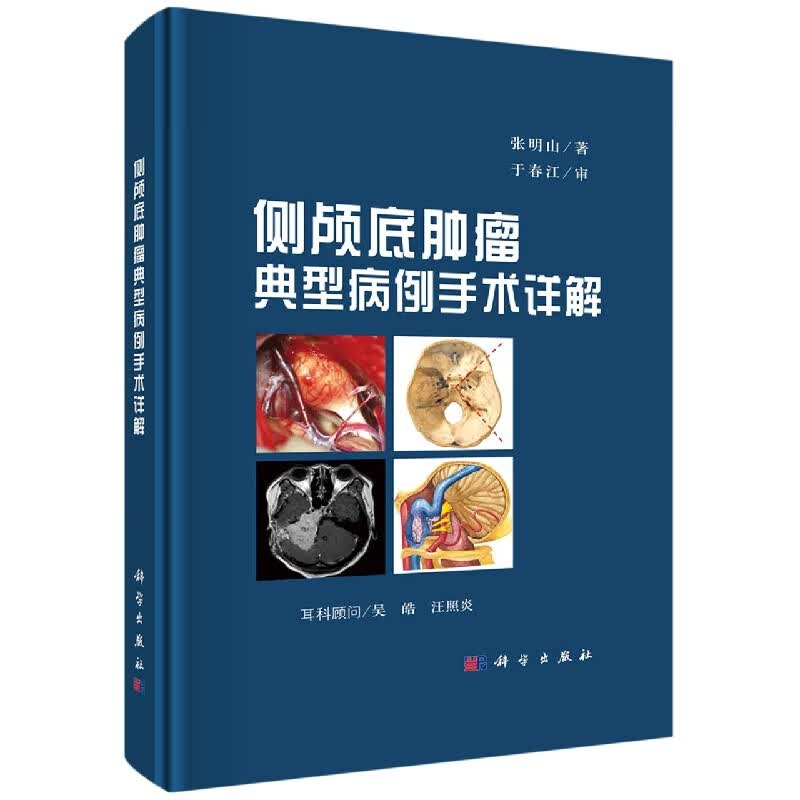侧颅底肿瘤典型病例手术详解(精)