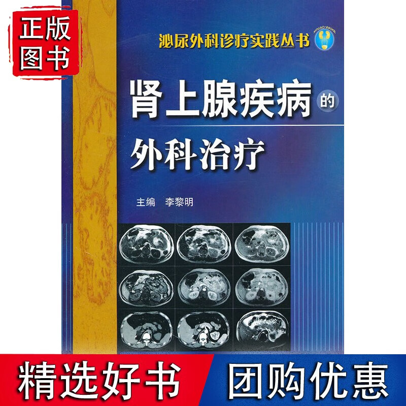 肾上腺疾病的外科治疗