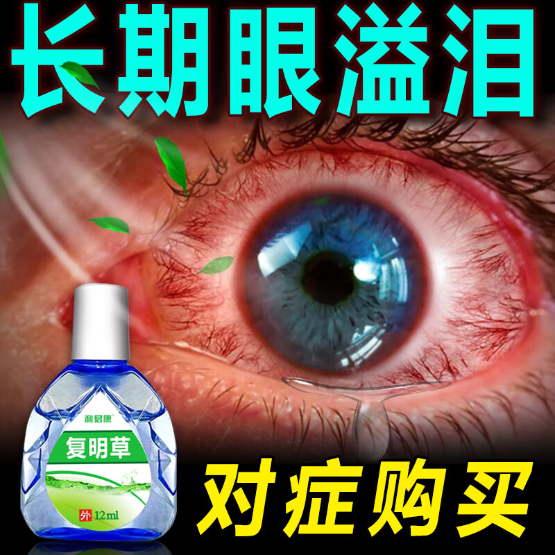 迎风流泪眼水眼怕风滴眼液怕光眼干眼涩发痒疲劳视物模糊看不清溢 一