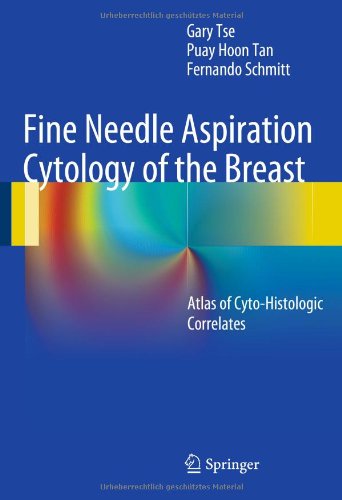 预订 fine needle aspiration cytology of the breast