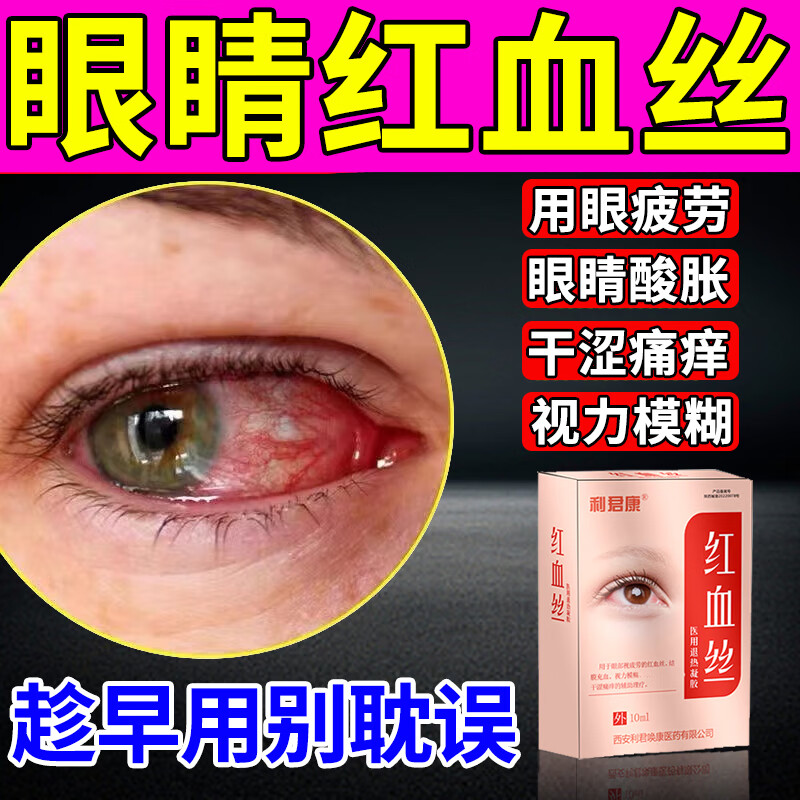 眼睛红血丝眼药水 眼睛干痒红血丝修复 眼疲劳干涩 酸胀发痒用眼过度