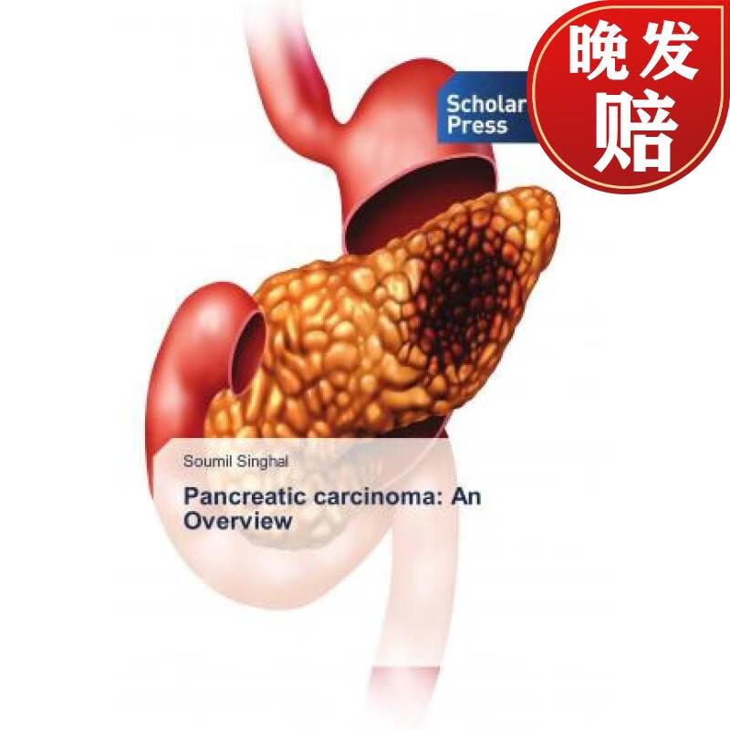 【4周达】pancreatic carcinoma: an overview