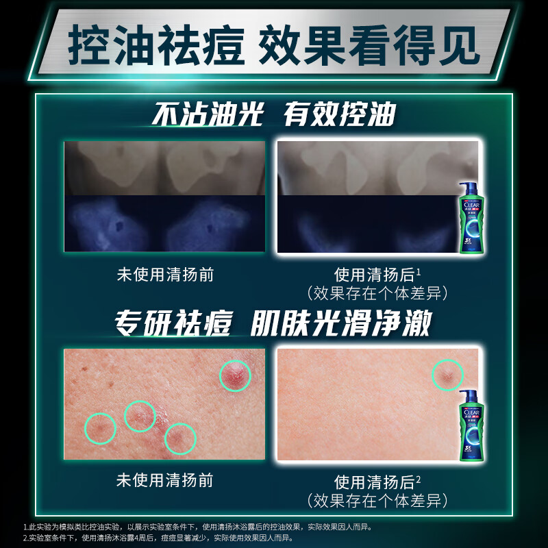 清扬（CLEAR）男士平衡净肤祛痘控油沐浴露600ml+卫宝除螨香皂105gC罗黎明觉醒