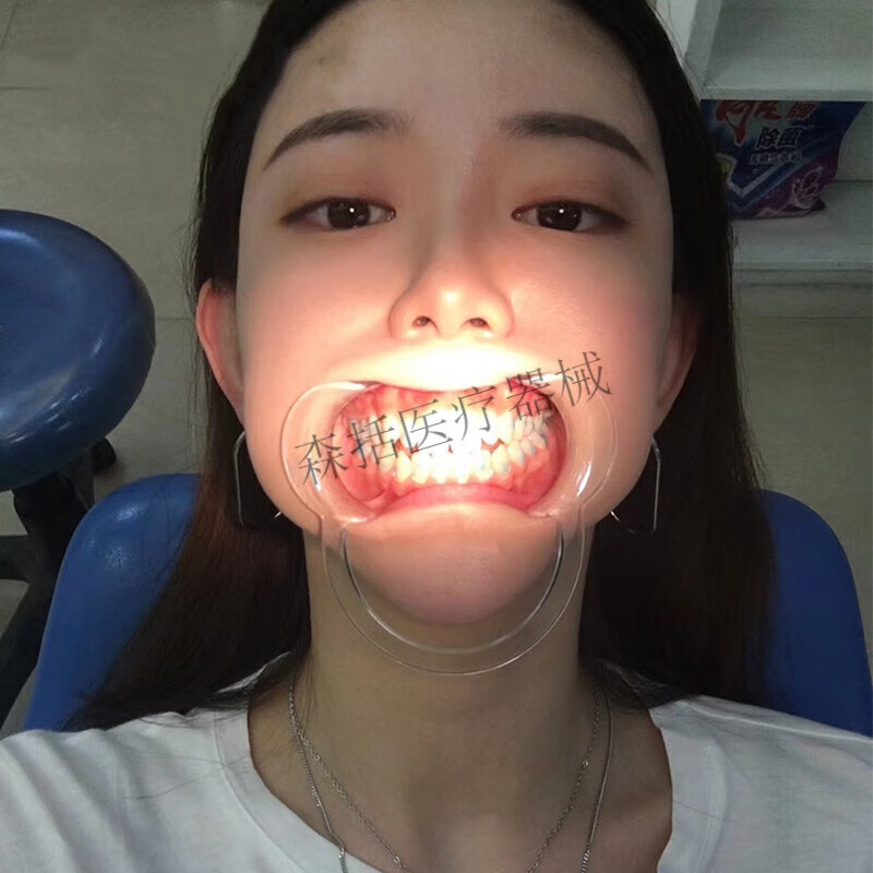 牙科m型带镜开口器 口撑张口器c型透明扩口器 蓝色牙齿撑嘴器 c型小号