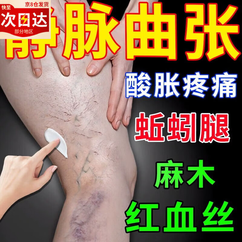 静脉曲张专用的药冷敷凝胶进口日本监制小腿部血管肿胀青筋突起蚯 单