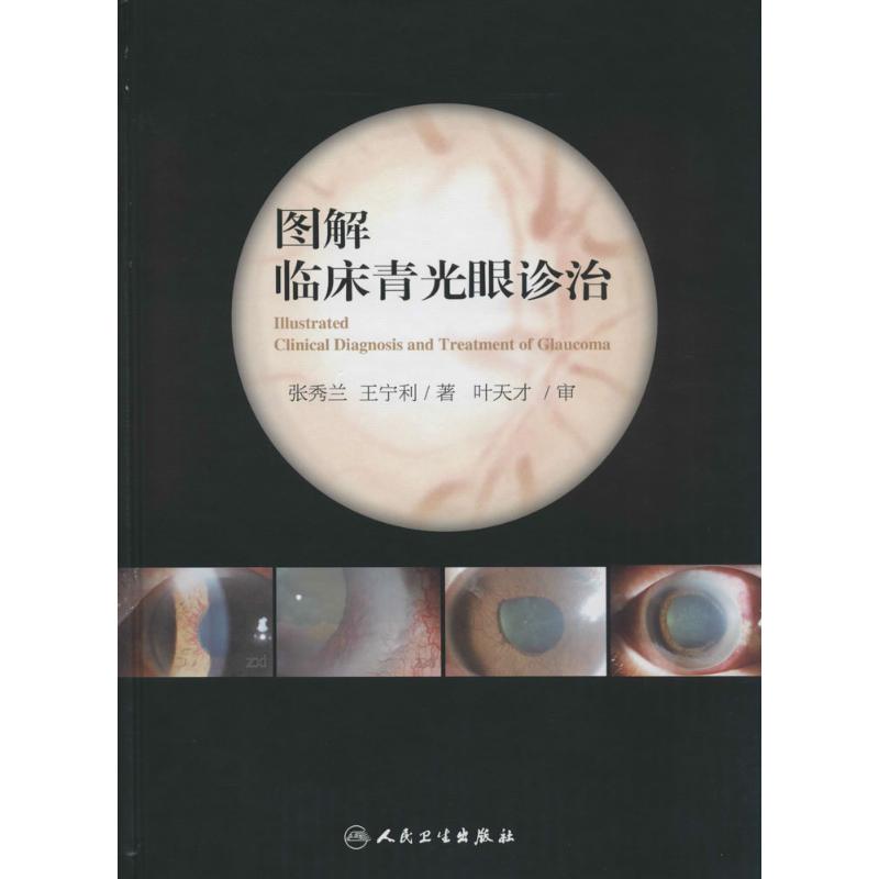 图解临床青光眼诊治 张秀兰 著 五官科 