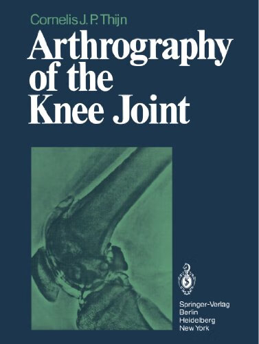 预订 arthrography of the knee joint